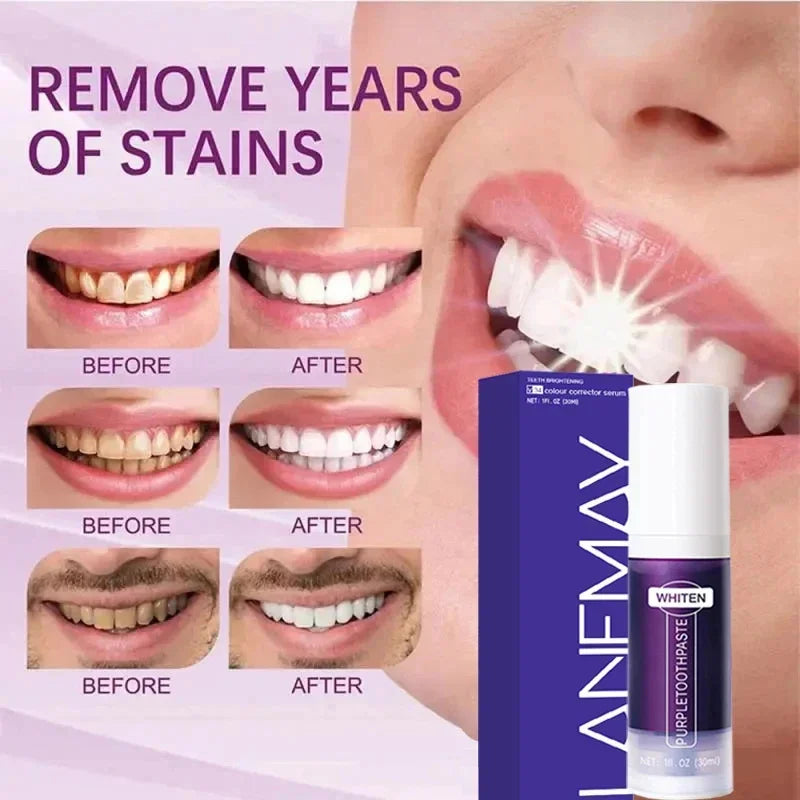 V34 Purple Teeth Whitening Toothpaste